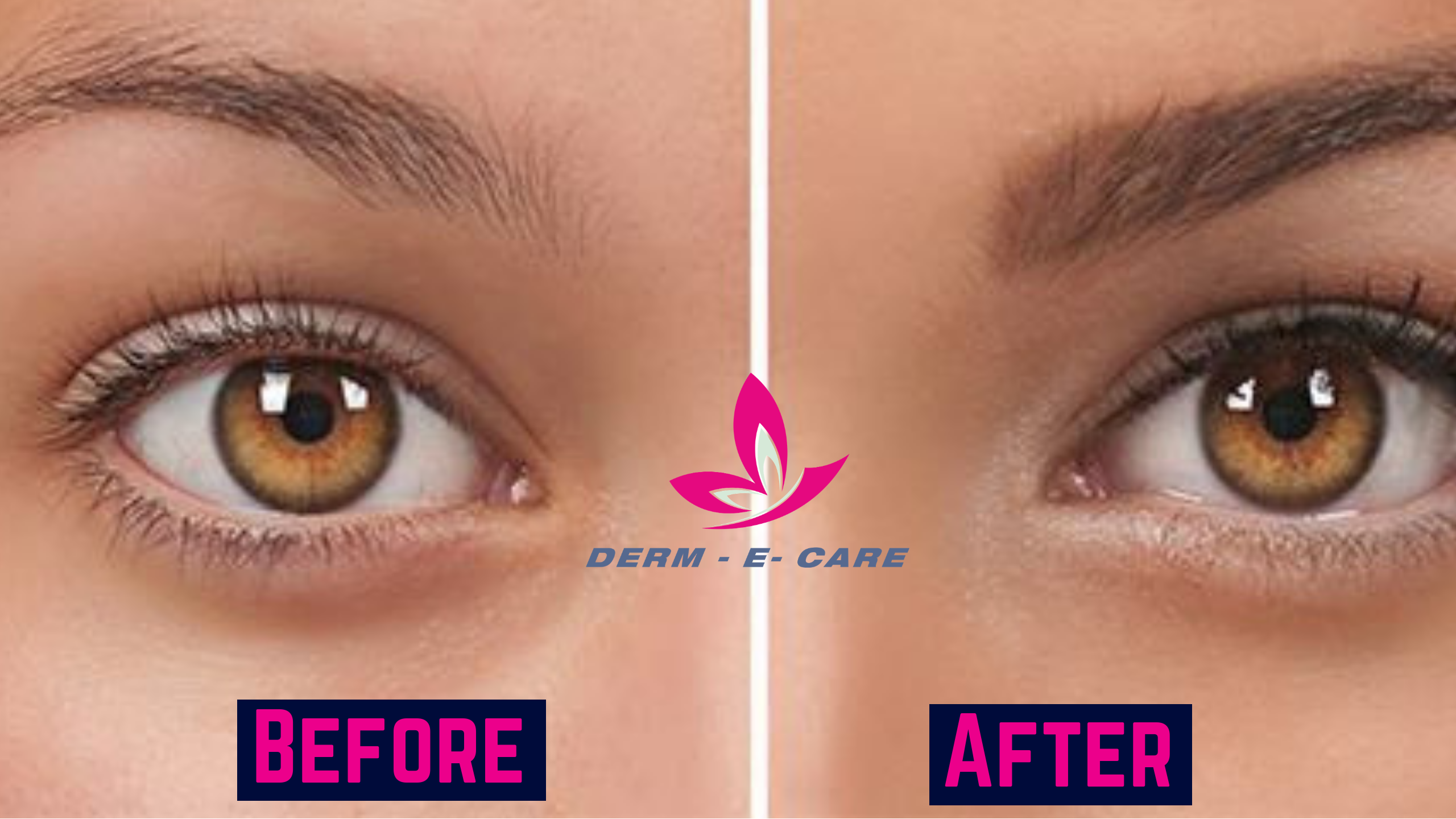 Permanent Makeup for Lipstick Eyeliner Beauty Spots and Eyelids CostPrice  in Andheri West Mumbai