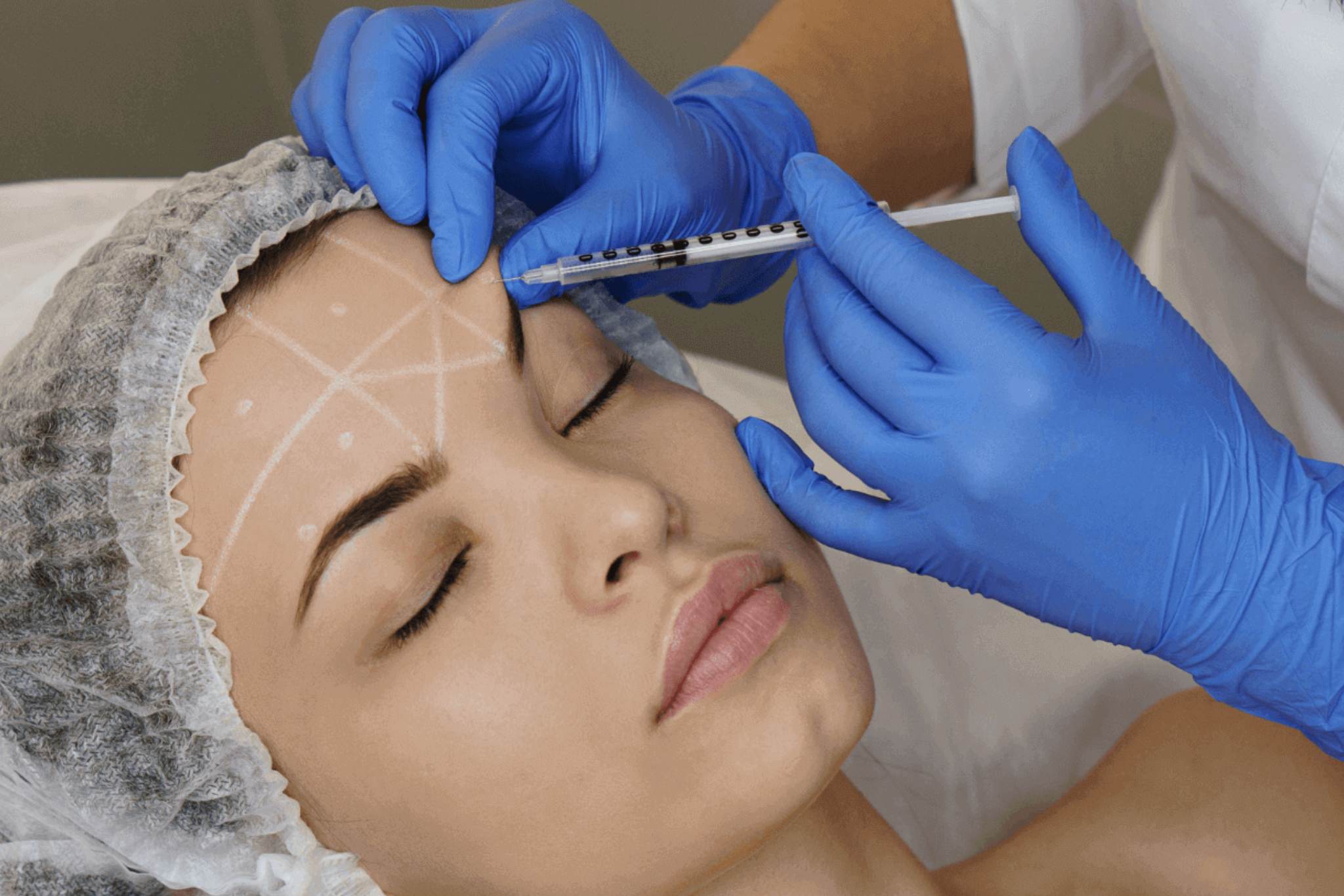 Dermecare Brow Lift Filler Procedure