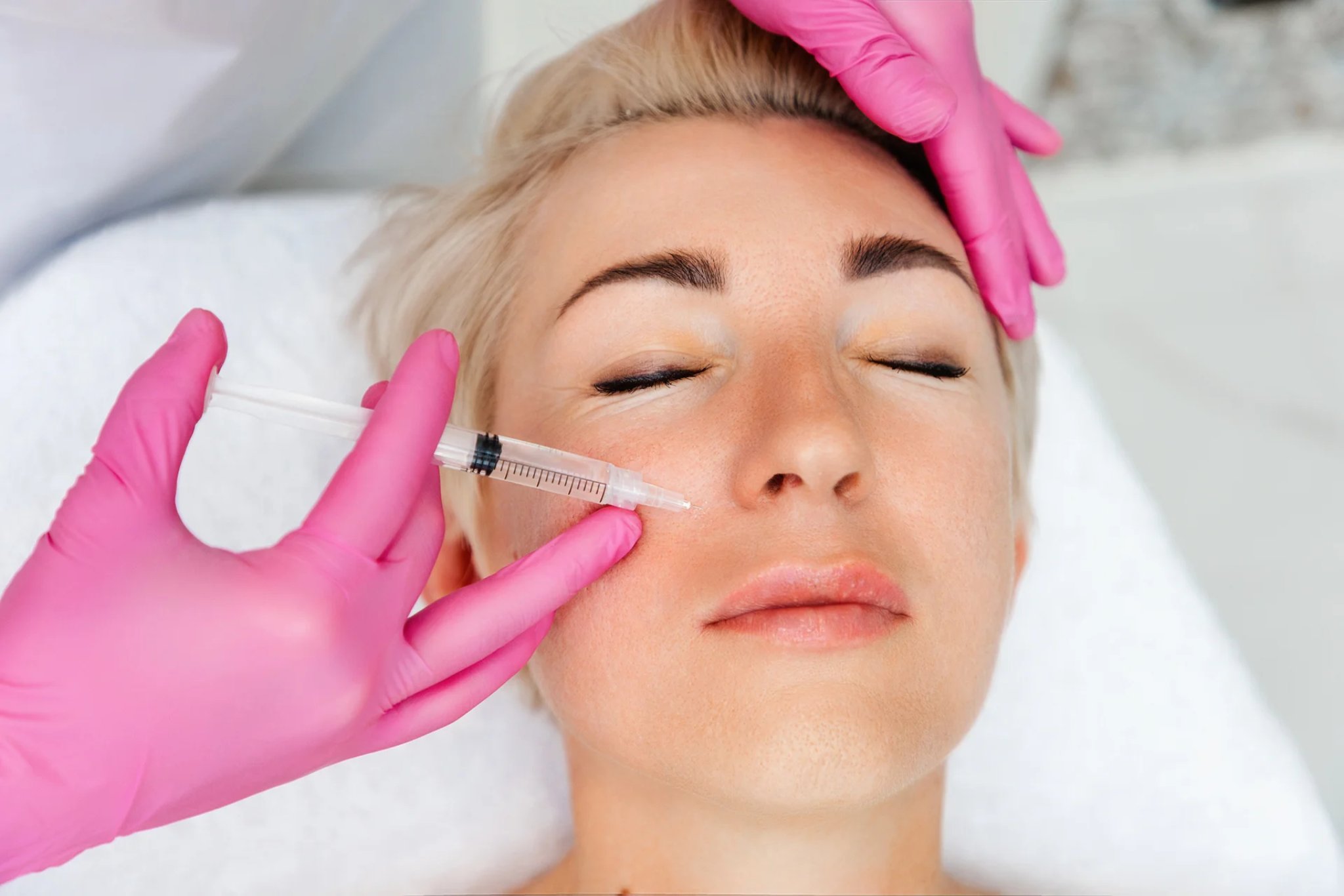 Dermecare Marionette Region Filler Procedure