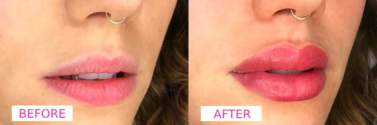 Lip Blush Procedure