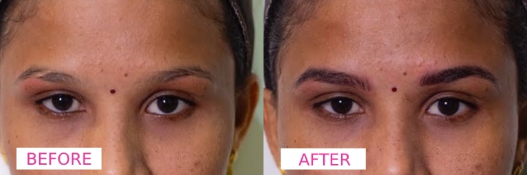 Microblading Eyebrows Before & After