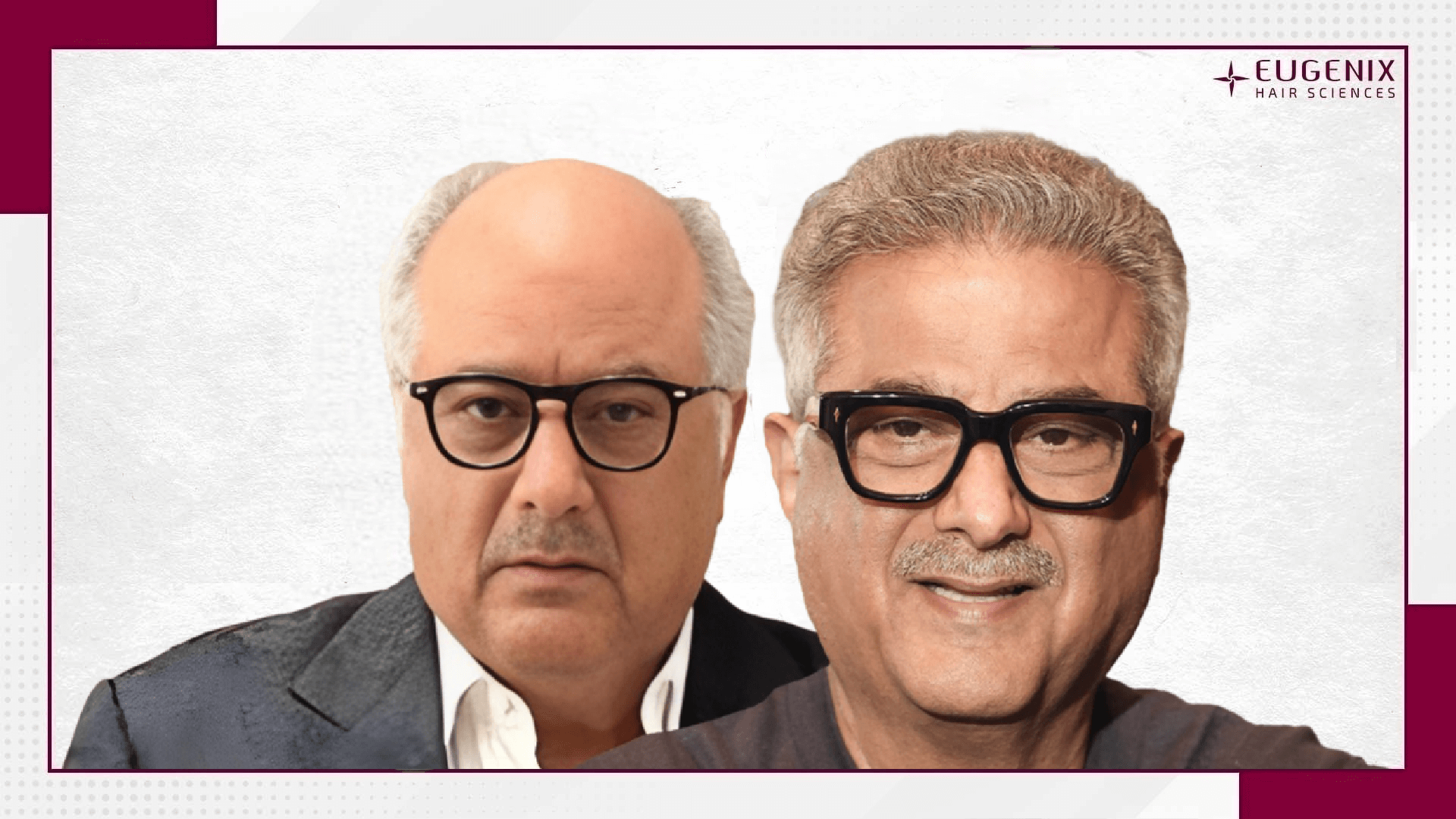 boney-kapoor-hair-transplant-results-new-1