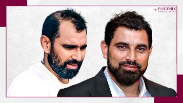 shami-hair-transplant-latest